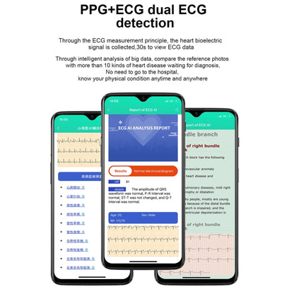 E86 1.7 inch TFT Color Screen IP68 Waterproof Smart Watch, Support Blood Oxygen Monitoring / Body Temperature Monitoring / AI Medical Diagnosis, Style: TPU Strap(Black) by bashfashion